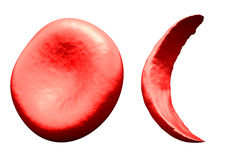 normaal-versus-sikkelrode-bloedcel-44305089